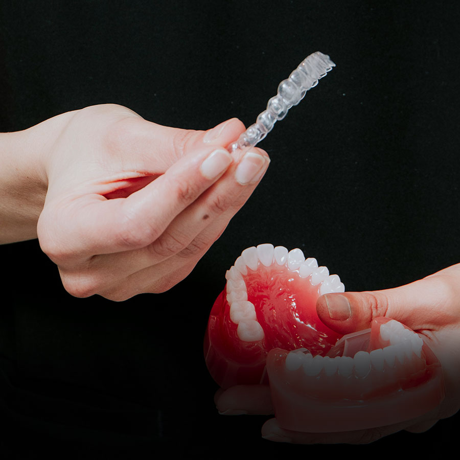 invisalign 2